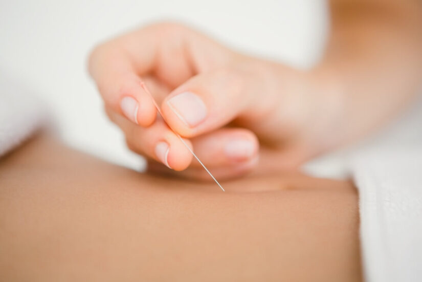 Discover the Healing Power of Chinese Acupuncture in Melbourne